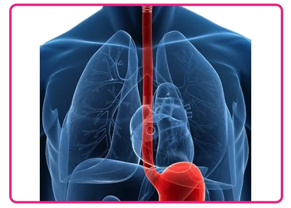 Esophageal Cancer Treatment