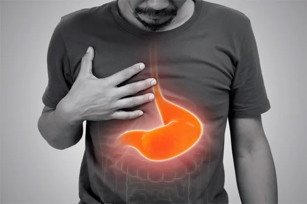 Stomach or  Gastric Cancer